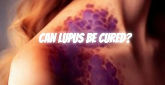 Can lupus be cured?