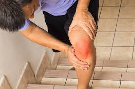 Symptoms of Rheumatoid Arthritis (RA) and Treatment