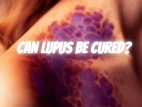 Can lupus be cured?